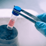 Kök hücre tedavisi