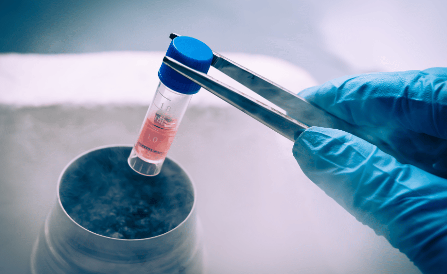 Kök hücre tedavisi