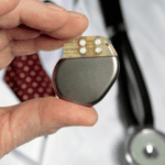 mesane pili cinsel fonksiyon