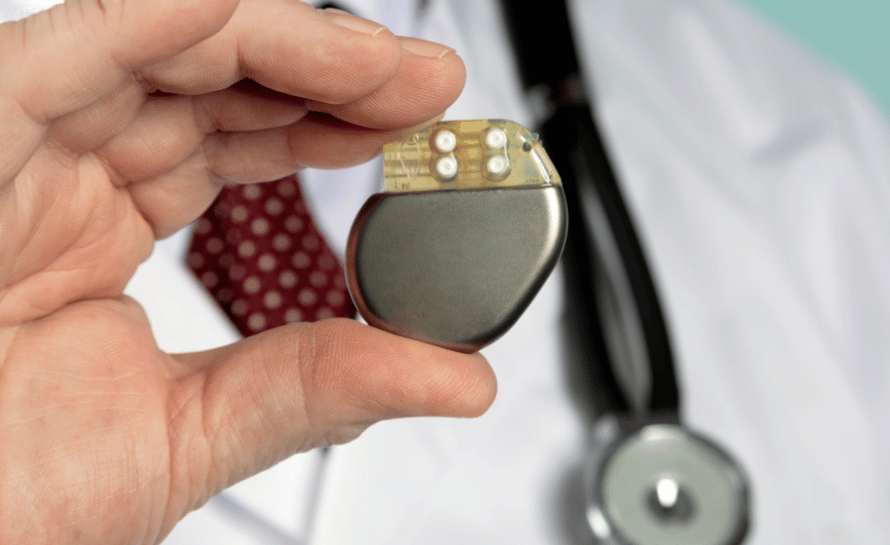 Sakral Nöromodülasyonun Cinsel Fonksiyon Üzerine Etkileri 15 mesane pili cinsel fonksiyon