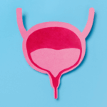 Aşırı aktif mesane nedir