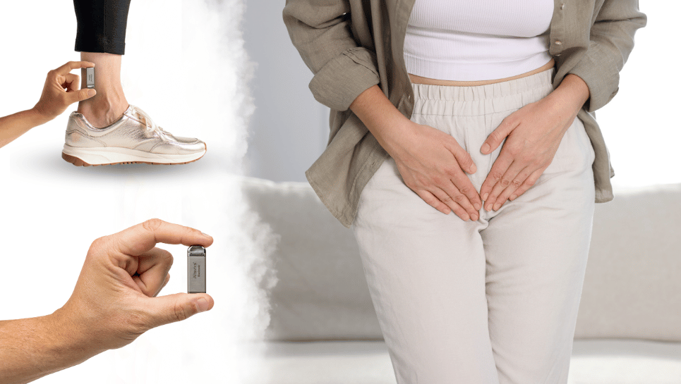 Aşırı Aktif Mesane Tedavisinde İmplant Edilebilir Tibial Nöromodülasyon (ITNM) 2 ITNM idrar kaçırma tedavisi