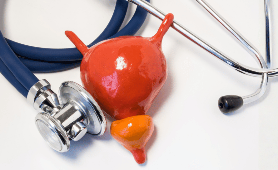 Prostat orta lob büyümesi (Median Lob Hiperplazisi)