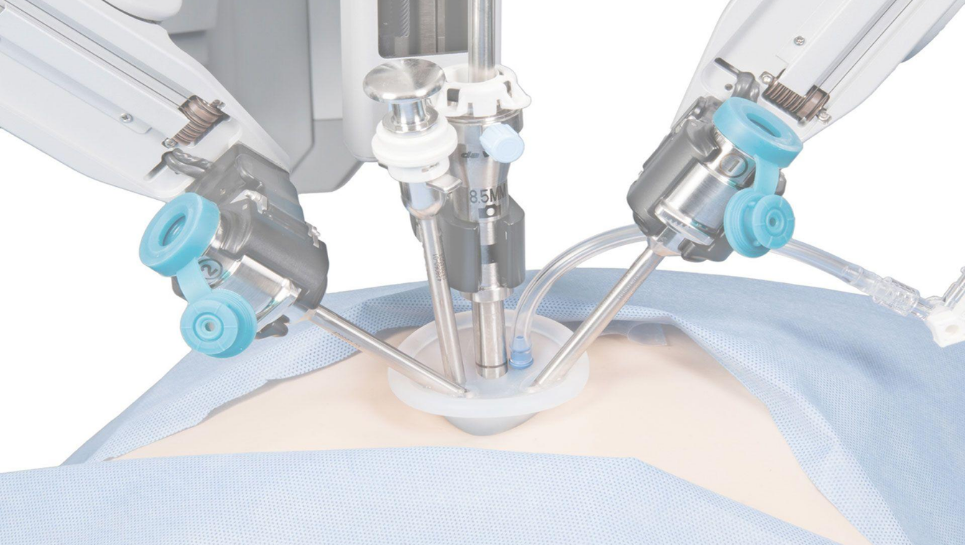 Single Port Robotik Rekonstrüktif Üroloji 3 tek delikten robotik ameliyat