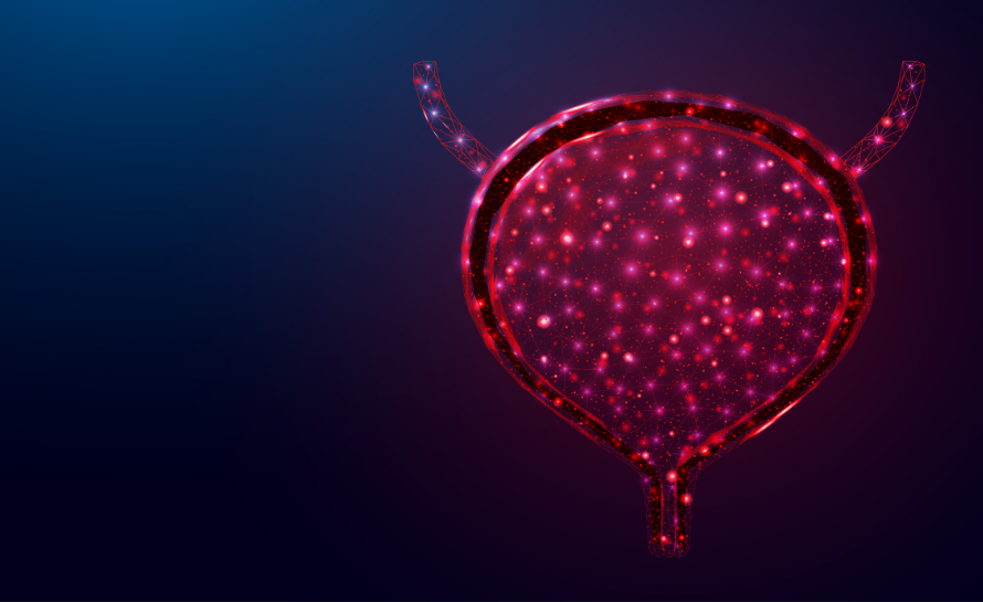 mesane kanseri varyantları kanserli hücreler