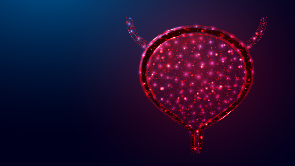 mesane kanseri varyantları kanserli hücreler