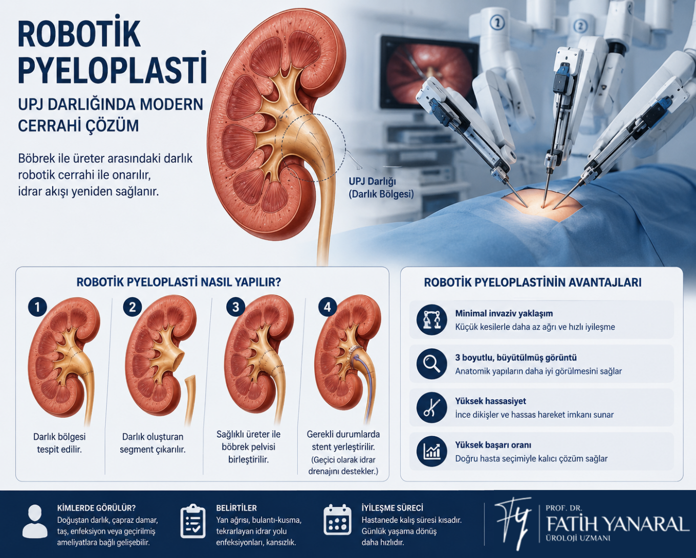 Robotik Pyeloplasti Nedir? 3 Robotik Pyeloplasti