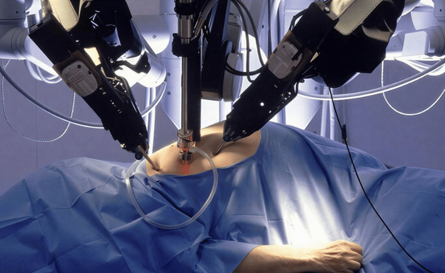 robotik pyeloplasti nedir