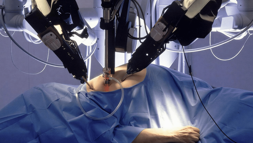 Robotik Pyeloplasti Nedir? 2 robotik pyeloplasti nedir