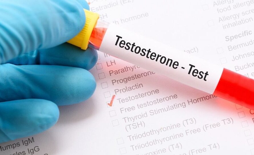 Testosteron eksikliği