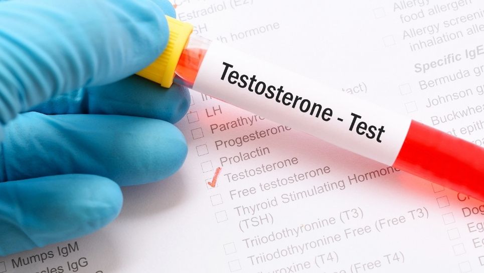 Testosteron Eksikliği: Belirtileri, Nedenleri ve Tedavi Yöntemleri 2 Testosteron eksikliği